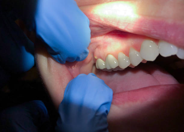 Best Weekend Emergency Dentist in Midwest City, OK