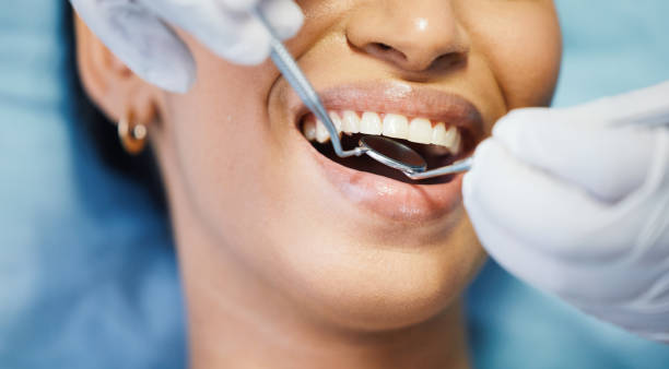 Best Emergency Tooth Extraction in Midwest City, OK